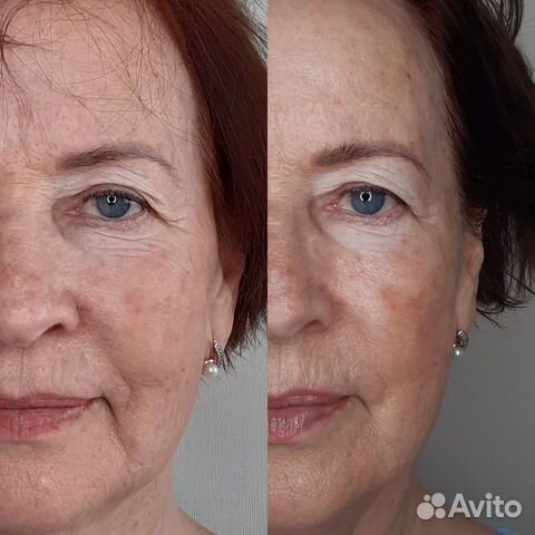 Косметолог / Массаж лица