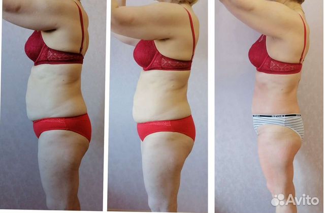 Массаж Аппаратный, Кавитация, RF-Лифтинг Вакуумный