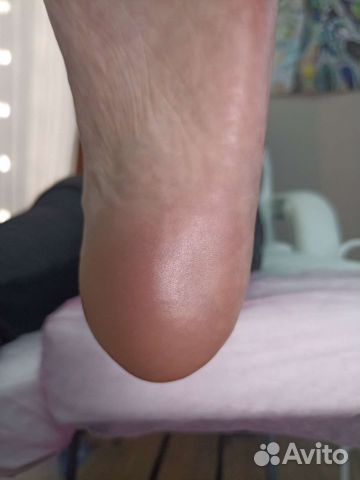 Смарт педикюр