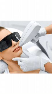 Лазерная эпиляция